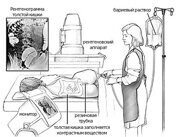 Что такое ирригоскопия кишечника и как она проводится смотреть видео